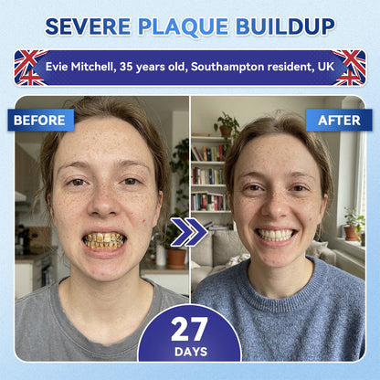 KLENIMORE® 🦷 Tideglusib Fast‑Dissolving Tooth & Gum Repair Oral Strips 💥🎉 (Supports tooth repair and helps relieve gum discomfort and other common oral concerns)