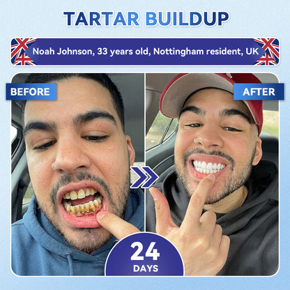 KLENIMORE® 🦷 Tideglusib Fast‑Dissolving Tooth & Gum Repair Oral Strips 💥🎉 (Supports tooth repair and helps relieve gum discomfort and other common oral concerns)