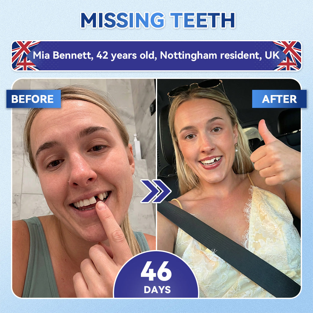 KLENIMORE® 🦷 Tideglusib Fast‑Dissolving Tooth & Gum Repair Oral Strips 💥🎉 (Supports tooth repair and helps relieve gum discomfort and other common oral concerns)